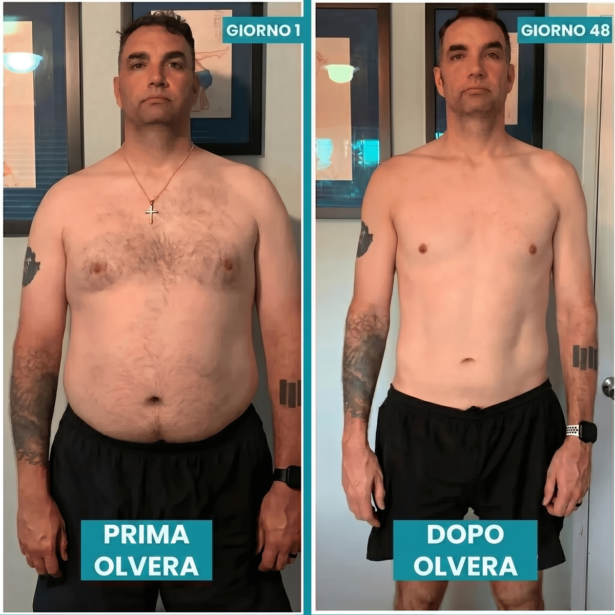 Prima / Dopo Olvera™ — risultati dopo 30 giorni