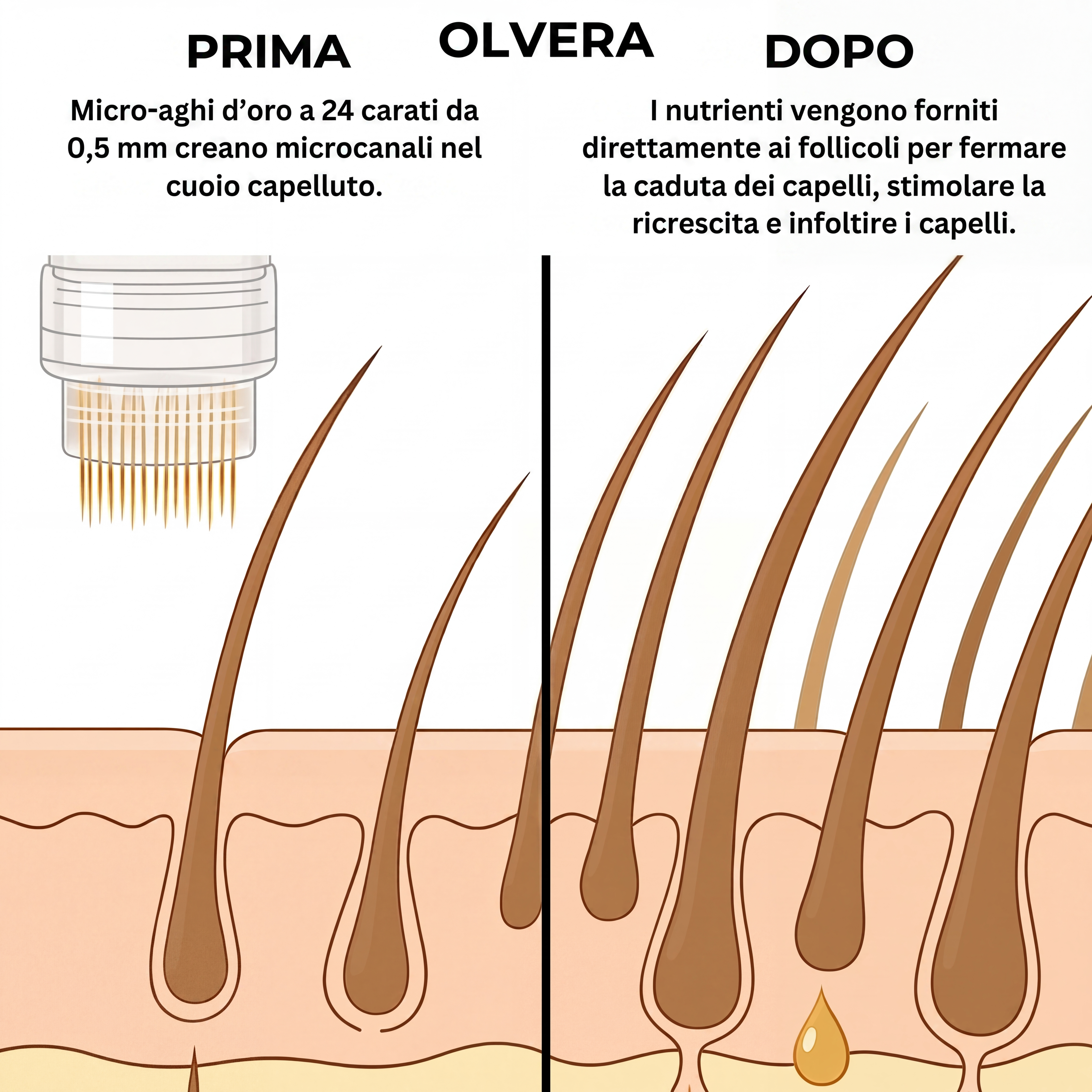 Tecnologia Capillare Micro-infuse® per Uomo